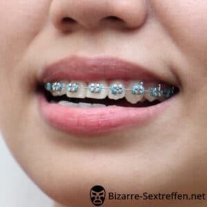 Sex trotz Zahnspange – junge Frau sucht Männer mit Zahnspangenfetisch